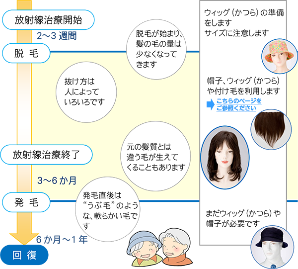 Survivorship Jp がんと向きあって 放射線治療と脱毛 脱毛について 治療時期と脱毛